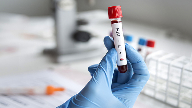 Lidí s HIV stále přibývá, někteří o tom roky nevědí. Před infekcí ochrání i pilulka