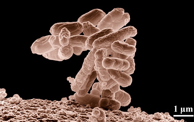 Bakterie E. coli může rozkládat odpad a přetvářet ho na léčiva, zjistili vědci
