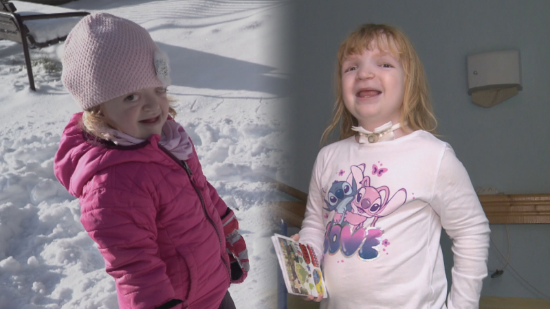 Šťastný konec malé Lilinky. Po sérii operací se změnila k nepoznání, maminka děkuje za podporu