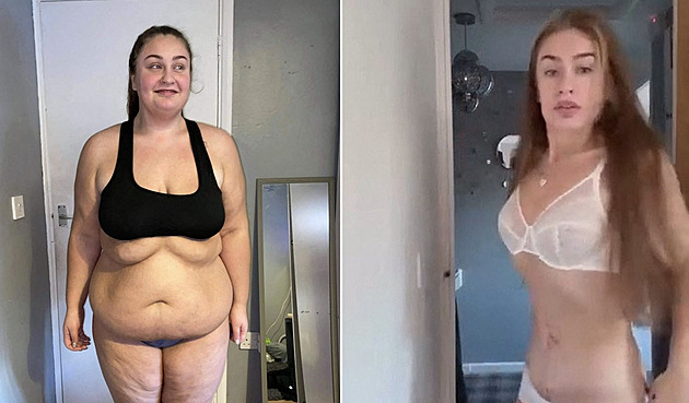 Nejdřív hubnutí a pak nutná operace. Žena se změnila k nepoznání