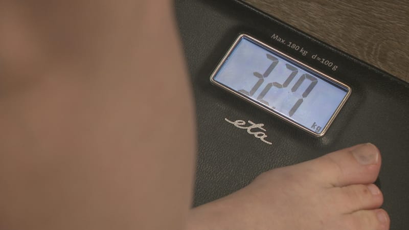 Lži, posedlost, výčitky. Anorexie ničí čím dál více dívek, odbornou pomoc vyhledá málokterá